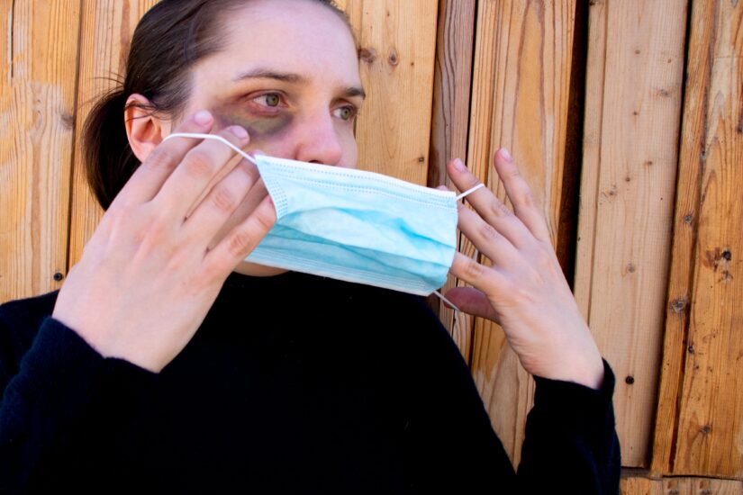 Photo of a Woman With a Bruised Eye Putting A Mask on